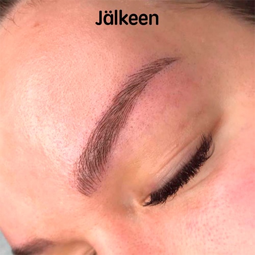 Microblading jälkeen